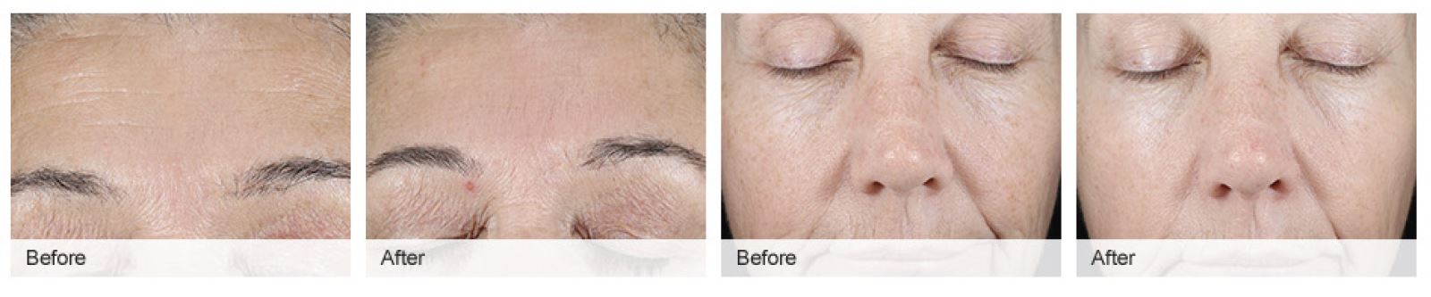 Clinical Solutions 8 Week Retinization Results image shows women anti-ageing skin care results